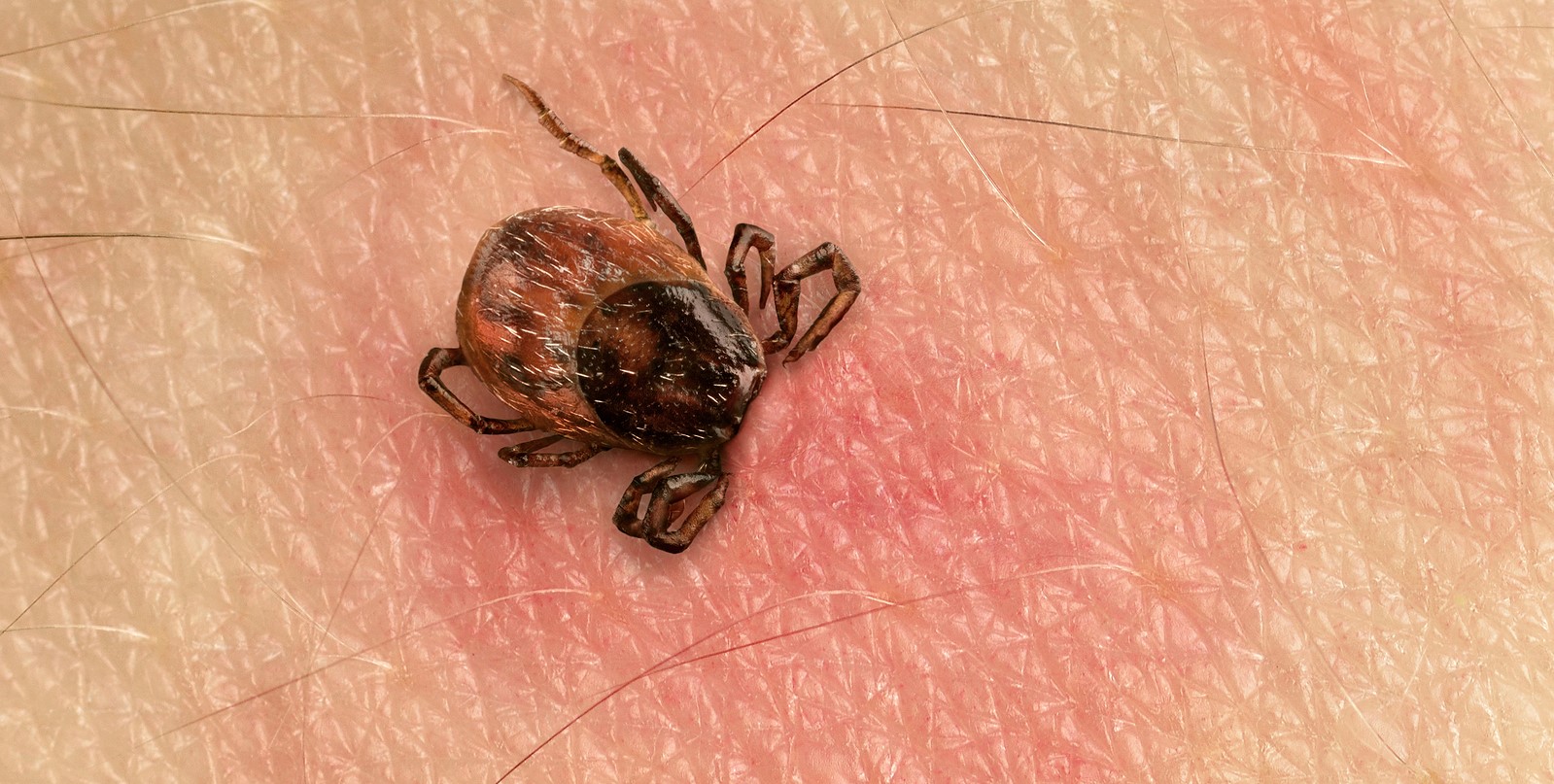 A piros folt Lyme-kór jele