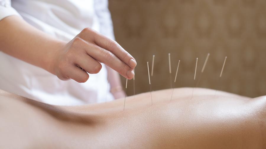 Hogyan segít az akupunktúra a cukorbetegség kezelésében?