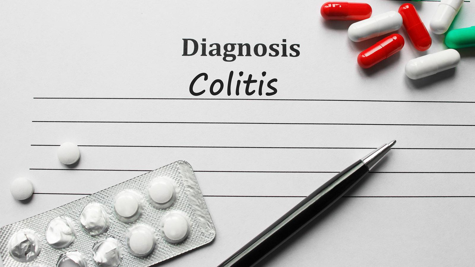 colitis-ulcerosa