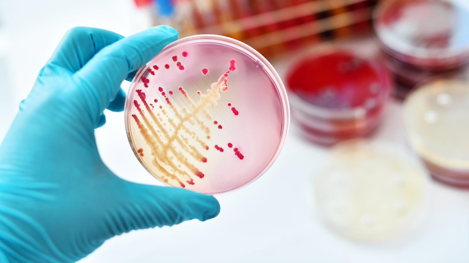 Visszatérő E. coli fertőzés
