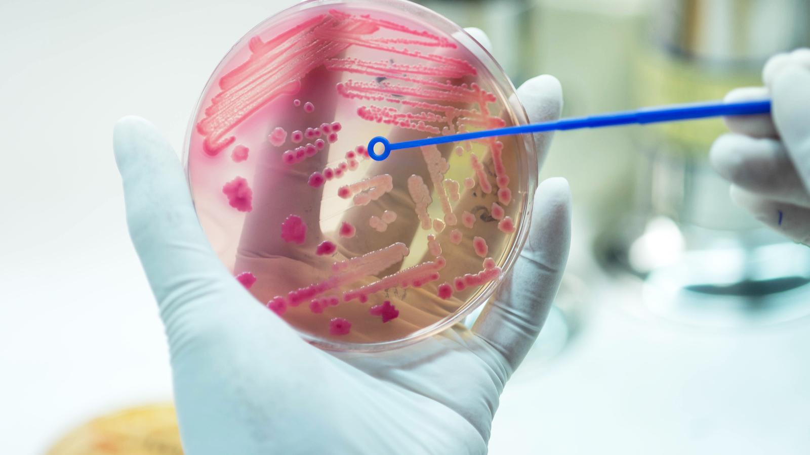 Az új antibotikum megöli a rezisztens baktériumokat