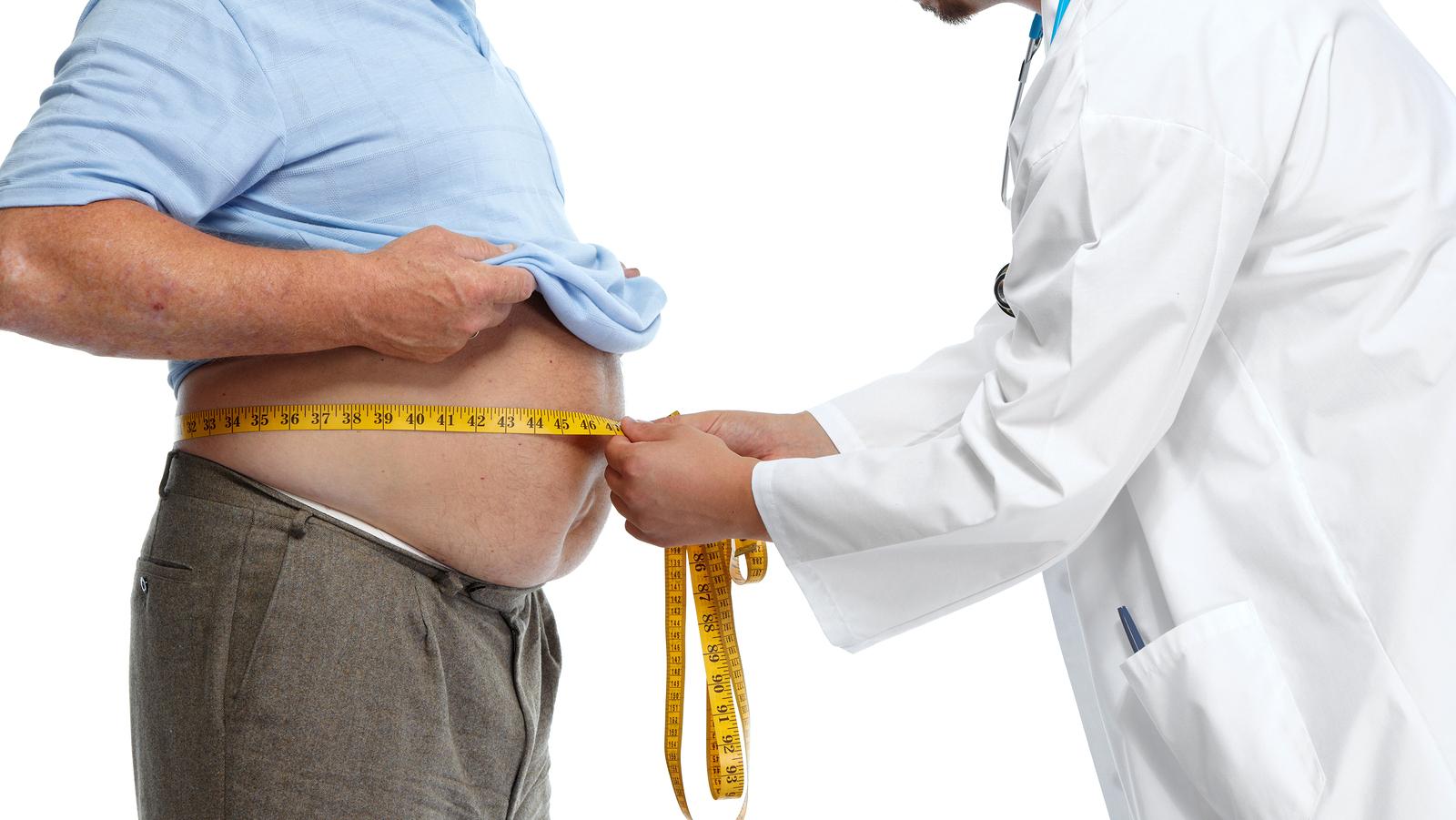 Kiderült az elhízás és a vastagbélrák közötti összefüggés