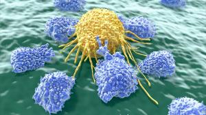 Áttörés a rákgyógyításban: Idegenektől származó immunsejteket használnának a betegség ellen
