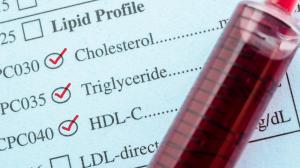Koleszterin | Tények és tévhitek a koleszterinnel kapcsolatban